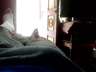 My leg is fracture 