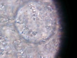 My sperm